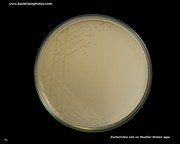 mueller hinton agar with ecoli